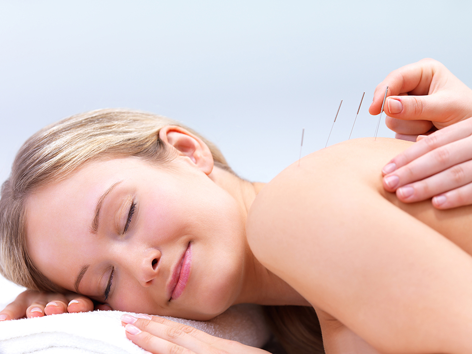 The Benefits of Acupuncture to Treat Alopecia